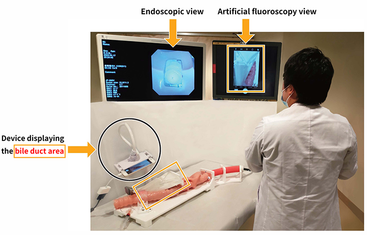 Image of simultaneous display of endoscopic and artificial fluoroscopic views